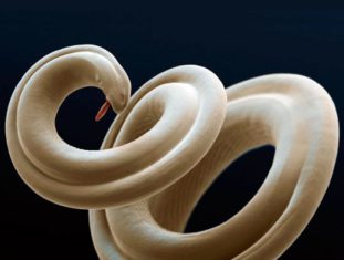 Гельминтные инвазии у людей