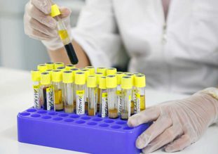 Контрольное исследование фекалий пациента проводят через 3 и 6 месяцев после курса лечения