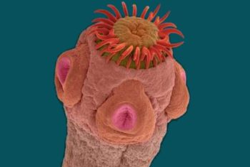 Свиной цепень