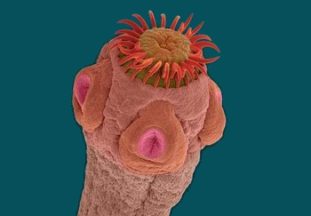 Фото: свиной цепень