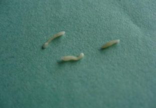 Членики огуречного цепня