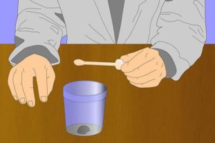 Зачем и как сдавать анализ кала?