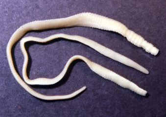 Бычий и свиной цепень у человека: симптомы, лечение