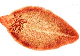 Что представляют собой трематодозы и как их лечить?