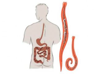 Глисты у человека
