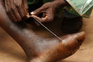 Фото: червь ришта