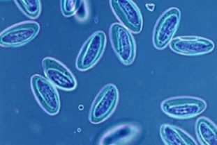 Что такое бластоцисты, лечение бластоцистоза