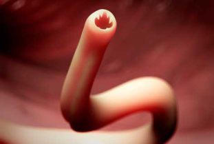 Особенности лечения кишечных паразитов и их диагностика