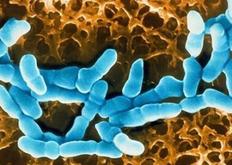 Гарднерелла