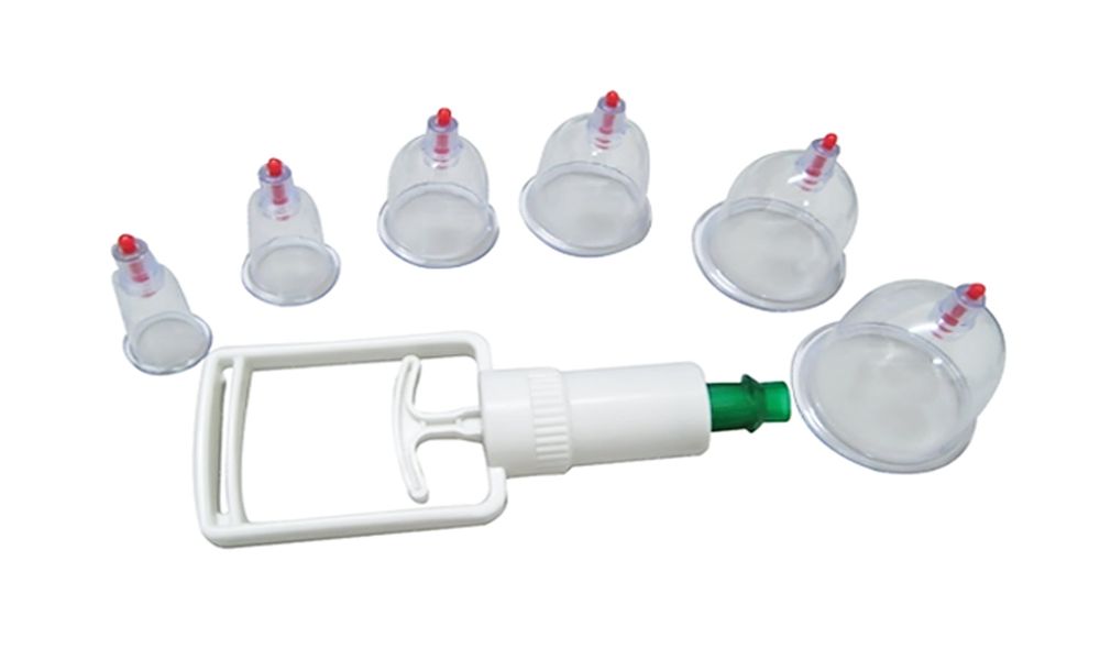 Хиджама точки для кровопускания и отзывы о процедуре