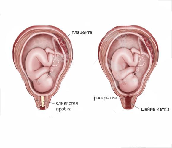 Когда отходит слизистая пробка у беременных перед родами?