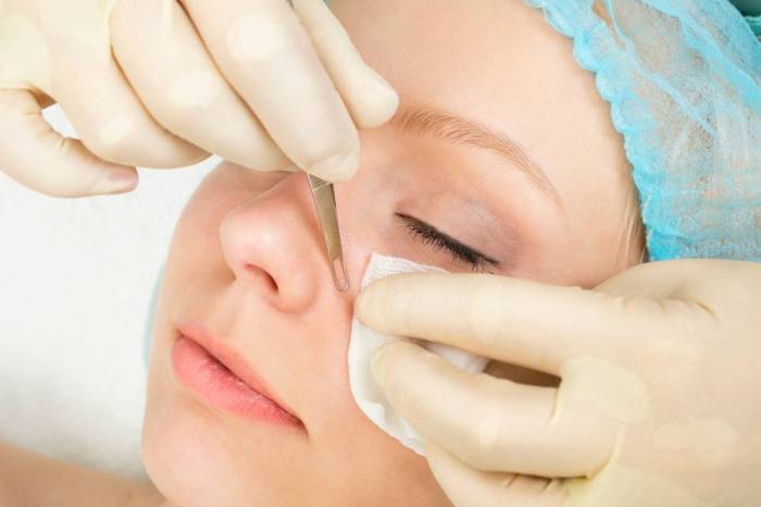Чистка кожи лица профессиональная и в домашних условиях