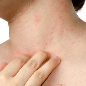 Таблетки от зуда кожи Зуд кожи: причины, средства и методы лечения