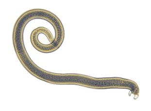 Фото: трихинелла